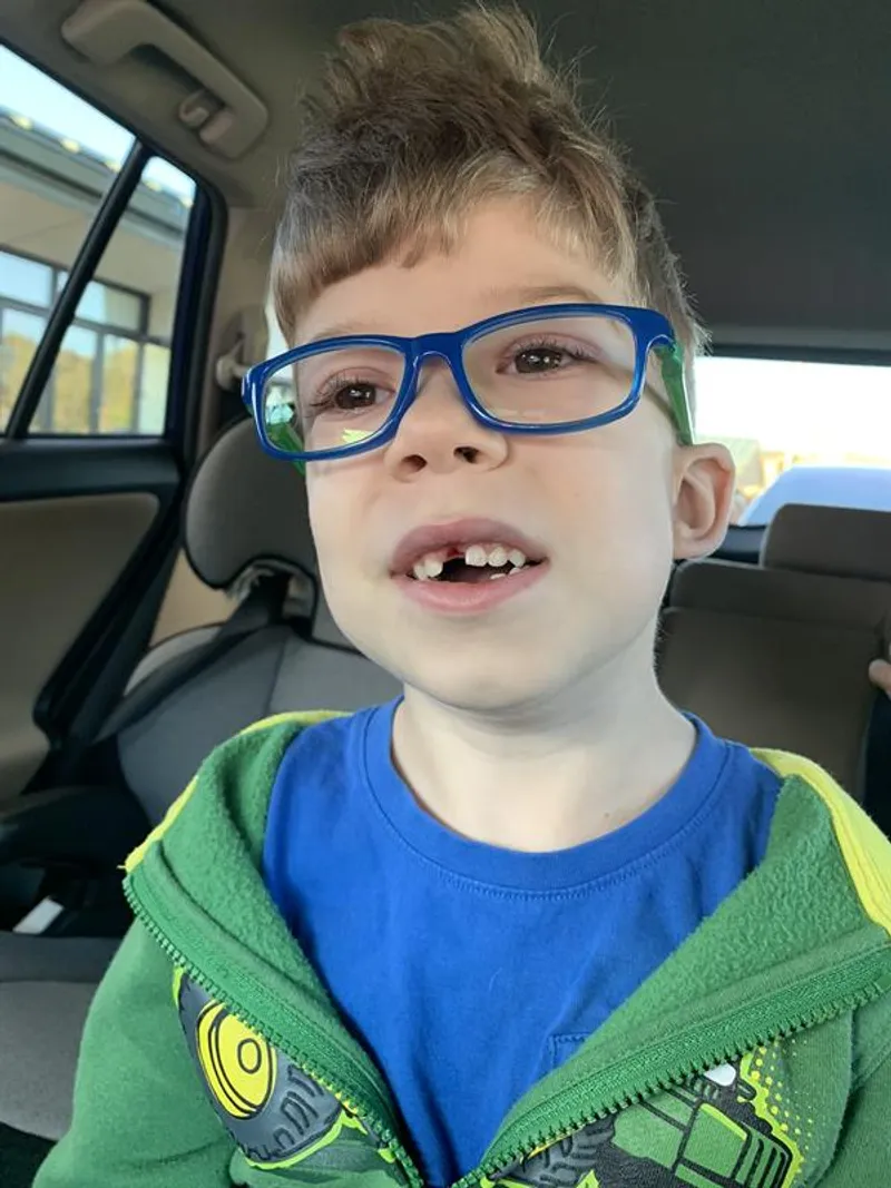 41 frankie front tooth